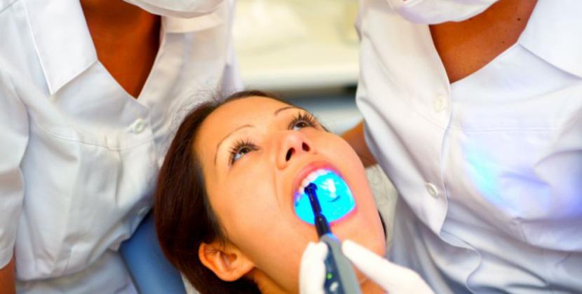 Consider Getting Beautiful Dental Veneers for the New Year