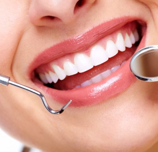 What You Should Know About A Dental Veneers In Birmingham MI