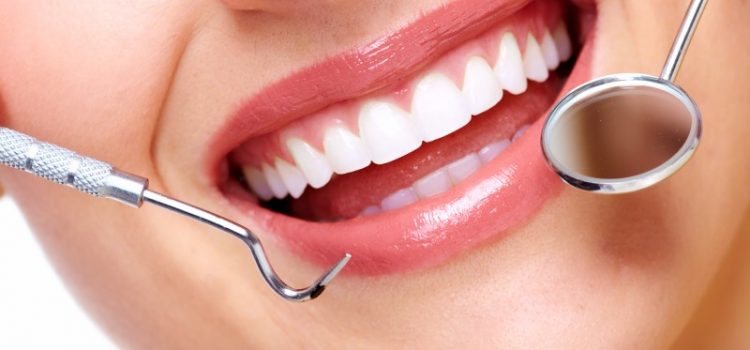What You Should Know About A Dental Veneers In Birmingham MI