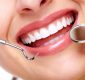 What You Should Know About A Dental Veneers In Birmingham MI