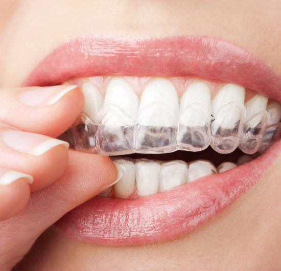 Signs That Indicate You Need to See an Orthodontist in Palm Coast
